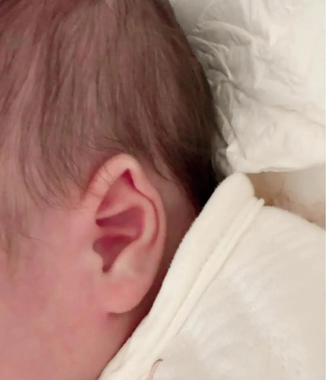 耳廓矫正2.0版本 真的有效！_1_mayomi_来自小红书网页版.jpg